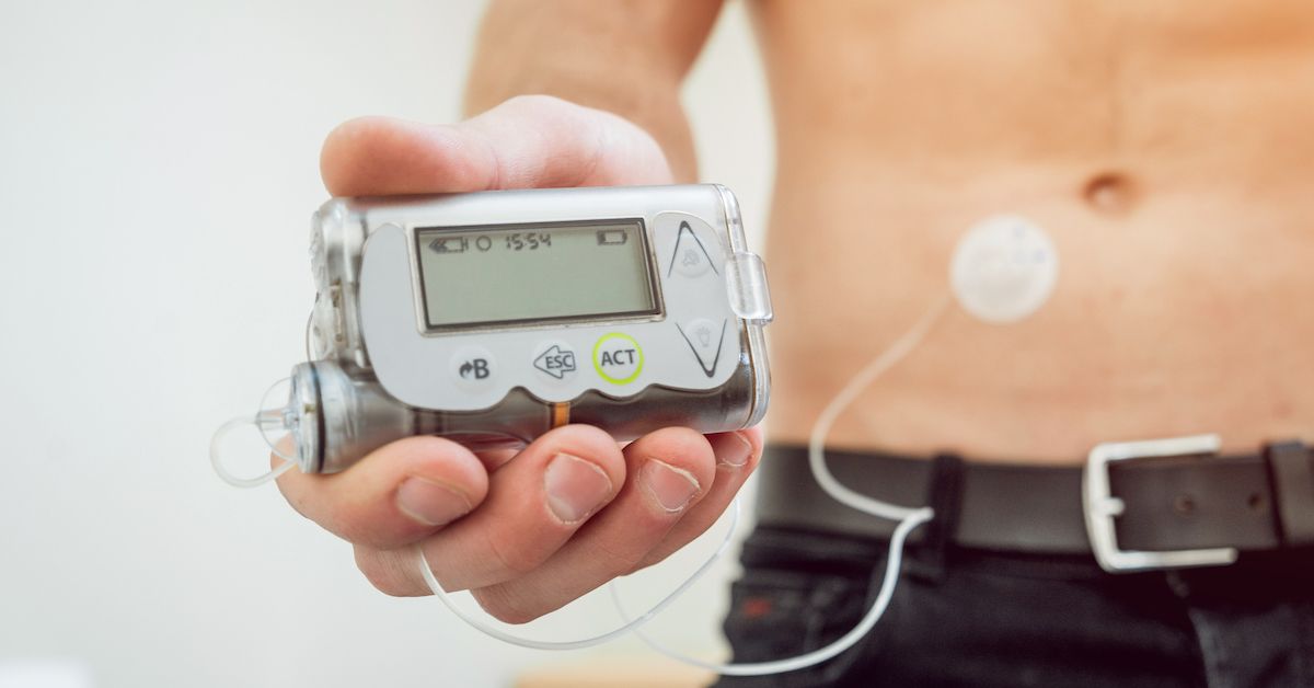 Understanding the Insulin Pump Recall